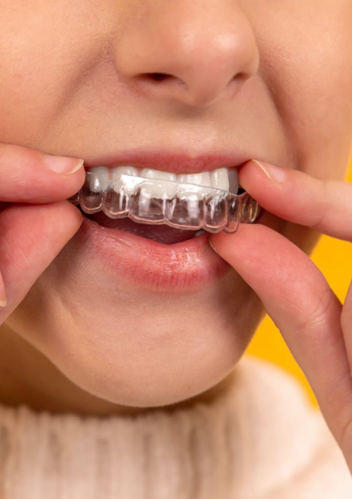 Jak wybrać dobrego ortodontę?